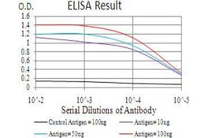 Black line: Control Antigen (100 ng), Purple line: Antigen(10 ng), Blue line: Antigen (50 ng), Red line: Antigen (100 ng), (KDM5B 抗体  (AA 231-319))