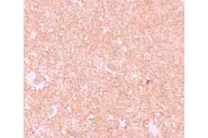 Immunohistochemical staining of human brain cells with NLRP10 polyclonal antibody  at 10 ug/mL. (NLRP10 抗体  (N-Term))
