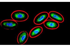 Immunofluorescence staining (chicken erythrocytes) (Vimentin 抗体)