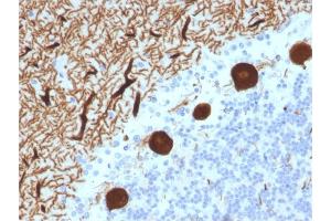 Formalin-fixed, paraffin-embedded human Cerebellum stained with CA8 Mouse Monoclonal Antibody (CPTC-CA8-2). (CA8 抗体)