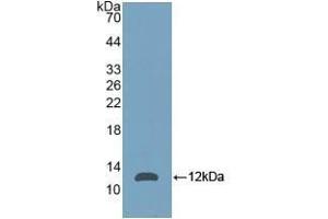 Detection of Recombinant NPM, Mouse using Polyclonal Antibody to Nucleophosmin 1 (NPM1) (NPM1 抗体  (AA 212-292))
