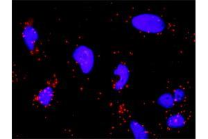 Proximity Ligation Analysis of protein-protein interactions between PTK2 and SRC. (Src 抗体  (AA 1-90))