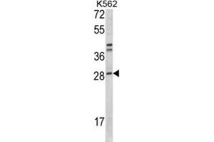 Western Blotting (WB) image for anti-Integrin beta 1 Binding Protein 3 (ITGB1BP3) antibody (ABIN3001631) (ITGB1BP3 抗体)