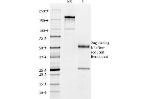 SDS-PAGE Analysis Purified CD32 Mouse Monoclonal Antibody (FCGR2A/479). (FCGR2A 抗体)
