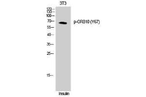 Western Blotting (WB) image for anti-Growth Factor Receptor-Bound Protein 10 (GRB10) (pTyr67) antibody (ABIN3182445) (GRB10 抗体  (pTyr67))