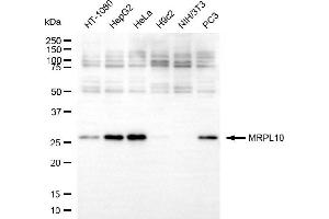 Western blotting analysis using MRPL10 antibody (ABIN7799429). (MRPL10 抗体)