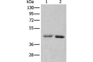Western blot analysis of A549 and Hela cell lysates using NADK2 Polyclonal Antibody at dilution of 1:1000 (NADK2 抗体)