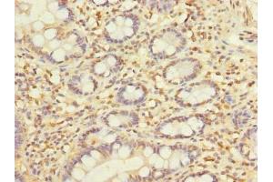 Immunohistochemistry of paraffin-embedded human small intestine tissue using ABIN7145334 at dilution of 1:100