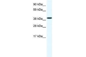 WB Suggested Anti-ANXA7 Antibody Titration:  1. (Annexin VII 抗体  (N-Term))