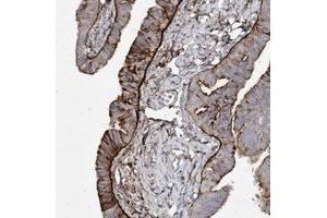 Immunohistochemical staining of human fallopian tube with LDLRAD3 polyclonal antibody  shows strong cytoplasmic and membranous positivity in glandular cells. (LDLRAD3 抗体)