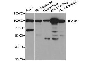 Western Blotting (WB) image for anti-Intercellular Adhesion Molecule 1 (ICAM1) antibody (ABIN1876800) (ICAM1 抗体)