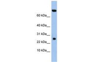 anti-Zinc Finger, SWIM-Type Containing 3 (ZSWIM3) (AA 35-84) antibody
