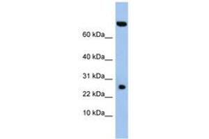 Image no. 1 for anti-Zinc Finger, SWIM-Type Containing 3 (ZSWIM3) (AA 35-84) antibody (ABIN6743750) (ZSWIM3 抗体  (AA 35-84))