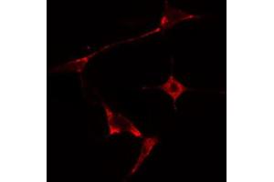 ABIN6274672 staining HepG2 cells by IF/ICC. (HSPB2 抗体  (Internal Region))