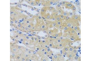 Immunohistochemistry of paraffin-embedded Mouse kidney using CABP7 Polyclonal Antibody at dilution of 1:100 (40x lens). (CABP7 抗体)