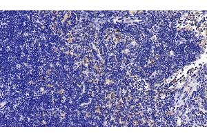 Immunohistochemistry (IHC) image for anti-Interleukin 1 Receptor Accessory Protein (IL1RAP) (AA 420-558) antibody (ABIN7438568)