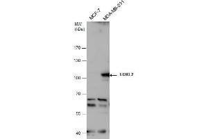 Western Blotting (WB) image for anti-Lysyl Oxidase-Like 2 (LOXL2) antibody (ABIN2856034)