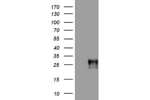 Western Blotting (WB) image for anti-Adiponectin (ADIPOQ) (AA 19-244) antibody (ABIN2715769) (ADIPOQ 抗体  (AA 19-244))