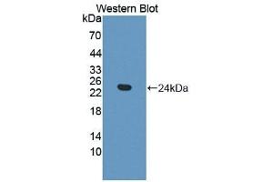 Detection of Recombinant Frataxin, Mouse using Polyclonal Antibody to Frataxin (FXN) (Frataxin 抗体  (AA 41-207))