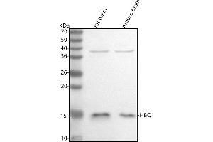 Western blot analysis of HBQ1 using anti-HBQ1 antibody (ABIN7598995).