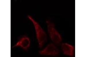 Immunofluorescence (fixed cells) (IF/ICC) image for anti-CD28 (CD28) (pTyr218) antibody (ABIN6255852)