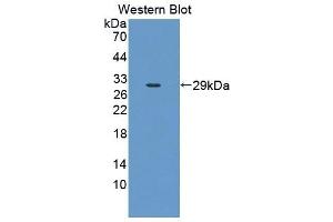 Detection of Recombinant CLTA, Mouse using Polyclonal Antibody to Clathrin, Light Polypeptide A (CLTA) (CLTA 抗体  (AA 5-234))