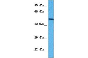 Western Blotting (WB) image for anti-UDP-Gal:betaGlcNAc beta 1,3-Galactosyltransferase, Polypeptide 2 (B3GALT2) (C-Term) antibody (ABIN2782253)