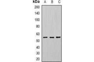 Western blot analysis of U2AF65 expression in Jurkat (A), SW620 (B), mouse spleen (C) whole cell lysates. (U2AF2 抗体)