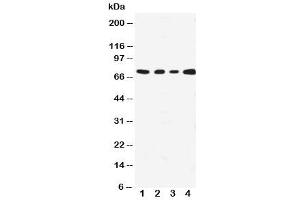 Western blot testing with MEKK3 antibody (MAP3K3 抗体  (N-Term))