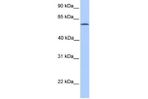 WB Suggested Anti-ACSBG2 Antibody Titration: 0. (ACSBG2 抗体  (Middle Region))