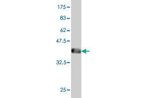 Western Blotting (WB) image for anti-Nudix (Nucleoside Diphosphate Linked Moiety X)-Type Motif 10 (NUDT10) (AA 1-164) antibody (ABIN566921)