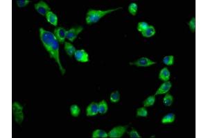Immunofluorescence staining of SH-SY5Y cells with ABIN7161352 at 1:133, counter-stained with DAPI.