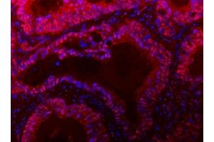 IF analysis of TIGD1 using anti-TIGD1 antibody (ABIN7602407).