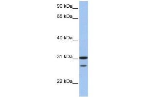 WB Suggested Anti-UBE2C Antibody Titration:  0. (UBE2C 抗体  (N-Term))