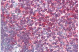 Immunohistochemistry (Paraffin-embedded Sections) (IHC (p)) image for anti-CD44 (CD44) antibody (ABIN396970)