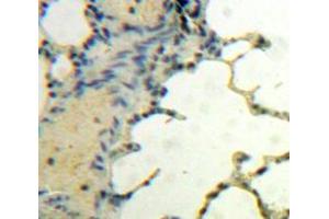 Used in DAB staining on fromalin fixed paraffin-embedded Lung tissue (BDNF 抗体  (AA 139-249))
