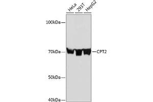 Western blot analysis of extracts of various cell lines, using CPT2 Rabbit mAb (ABIN7266090) at 1:1000 dilution. (CPT2 抗体)