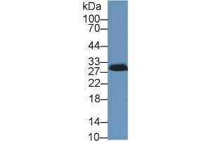 Western blot analysis of Pig Adrenal gland lysate, using Human STAR Antibody (1 µg/ml) and HRP-conjugated Goat Anti-Rabbit antibody ( (STAR 抗体  (AA 1-285))