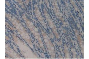 IHC-P analysis of Mouse Intestine Tissue, with DAB staining. (COMP 抗体  (AA 554-753))