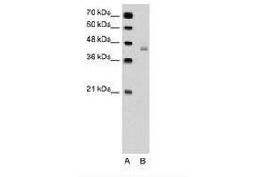 Image no. 1 for anti-DEAH (Asp-Glu-Ala-His) Box Polypeptide 30 (DHX30) (AA 51-100) antibody (ABIN6736327) (DHX30 抗体  (AA 51-100))
