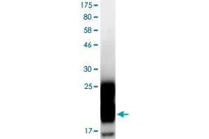 Western Blotting (WB) image for CD276 (CD276) (AA 28-140) protein (His-DYKDDDDK-Strep II Tag) (ABIN4369856)
