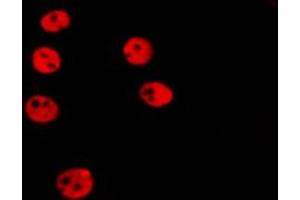 ABIN6266522 staining HepG2 by IF/ICC. (Cyclin A 抗体)