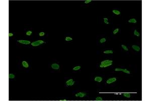 Immunofluorescence of monoclonal antibody to ASF1B on HeLa cell. (ASF1B 抗体  (AA 1-202))