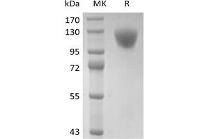 Western Blotting (WB) image for CD45RA (CD45RA) protein (His tag) (ABIN7319928) (CD45RA Protein (CD45RA) (His tag))