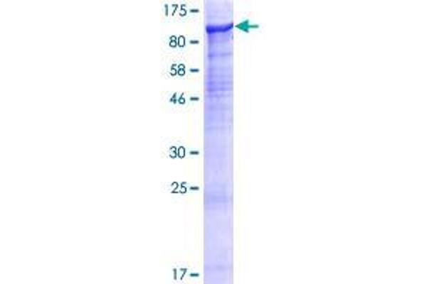 SUSD2 Protein (AA 1-822) (GST tag)