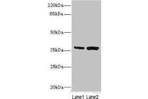 Western blot All lanes: C1GALT1C1 antibody at 3.