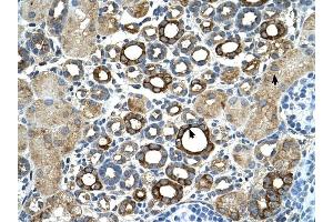 ST14 antibody was used for immunohistochemistry at a concentration of 4-8 ug/ml to stain Epithelial cells of renal tubule (arrows) in Human Kidney. (ST14 抗体)