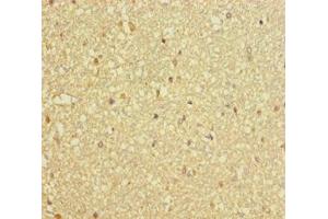 Immunohistochemistry of paraffin-embedded human brain tissue using ABIN7150811 at dilution of 1:100 (DCTN3 抗体  (AA 2-176))