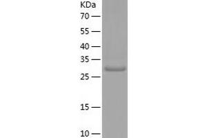 Western Blotting (WB) image for Adenosylmethionine Decarboxylase 1 (AMD1) (AA 68-334) protein (His tag) (ABIN7121713) (AMD1 Protein (AA 68-334) (His tag))