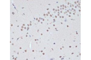 Immunohistochemistry of paraffin-embedded Mouse brain using Phospho-Jak2(Y1007/1008) Polyclonal Antibody at dilution of 1:200 (40x lens). (JAK2 抗体  (pTyr1007, pTyr1008))